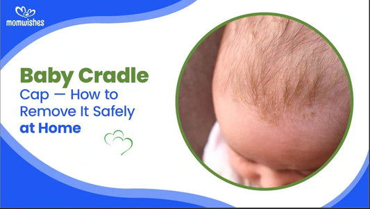 Baby Cradle Cap How to Remove It